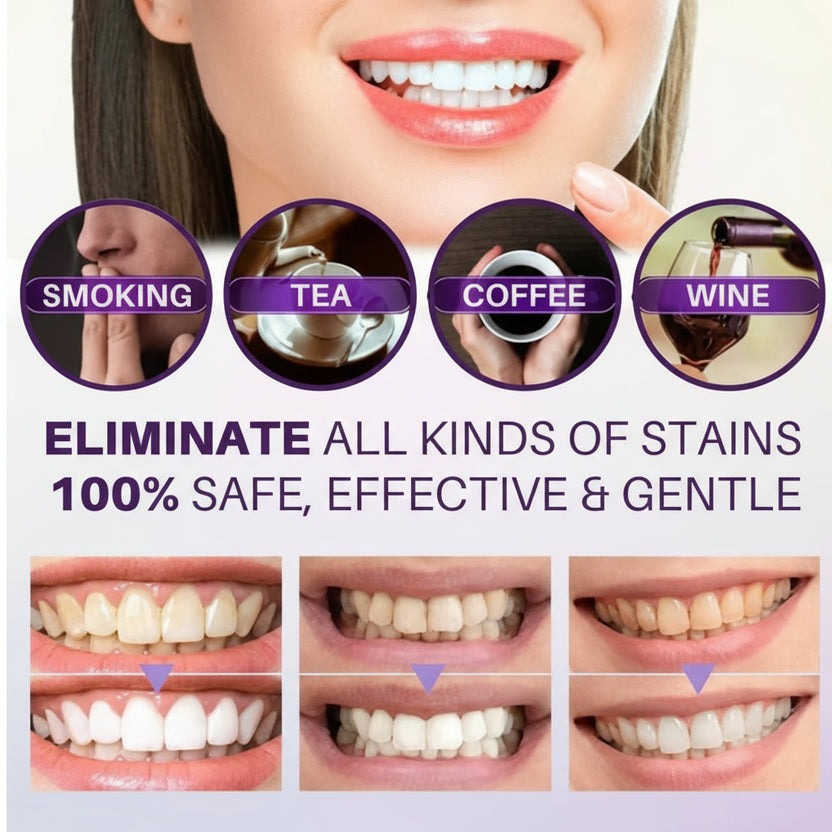 Hismile - Teeth Brightening Serum V34